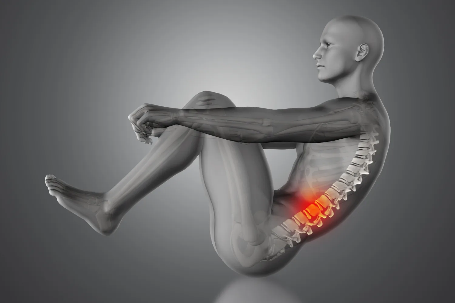 Cirugía de hernia de disco lumbar